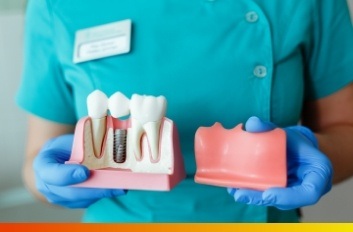 Dentist holding a model of a dental implant in the jaw