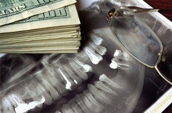 Money next to a dental x-ray