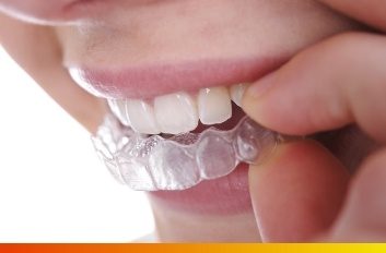 Close up of person placing Invisalign in Brooklyn over their teeth