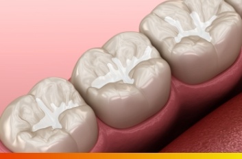 Animated row of teeth with tooth colored fillings