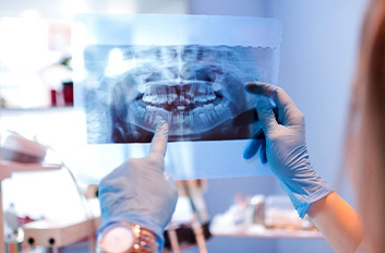 Model of tooth showing root canals inside of it